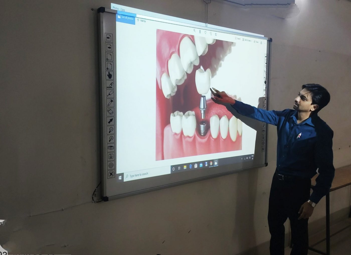 Class II Amalgam Cavity Preparartion - ppt video online download